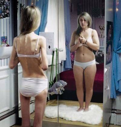 anorexia_979_20101214105137_53